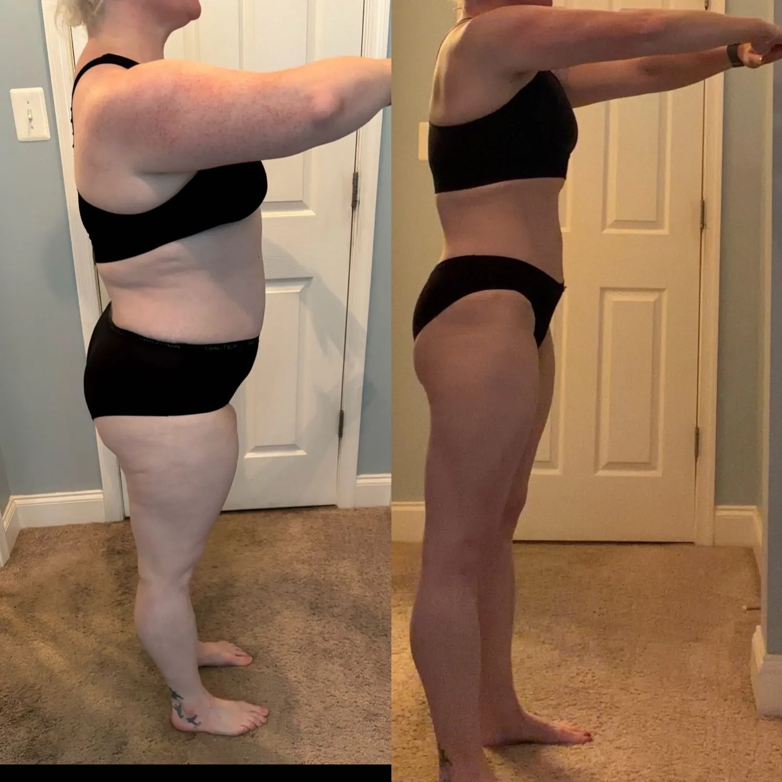 Weight-loss transformation, side view, before and after